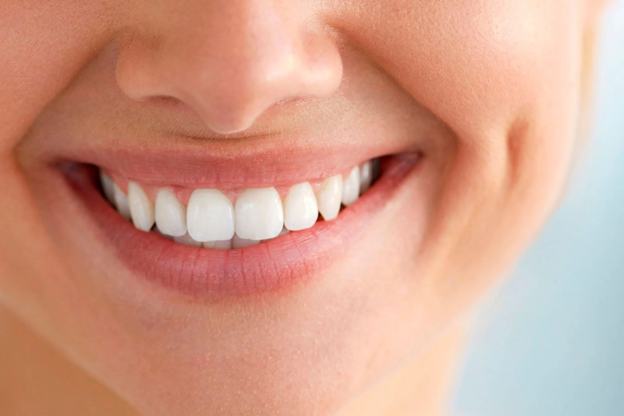 Dame smiler efter Litewire tandretning hos Hvidtand